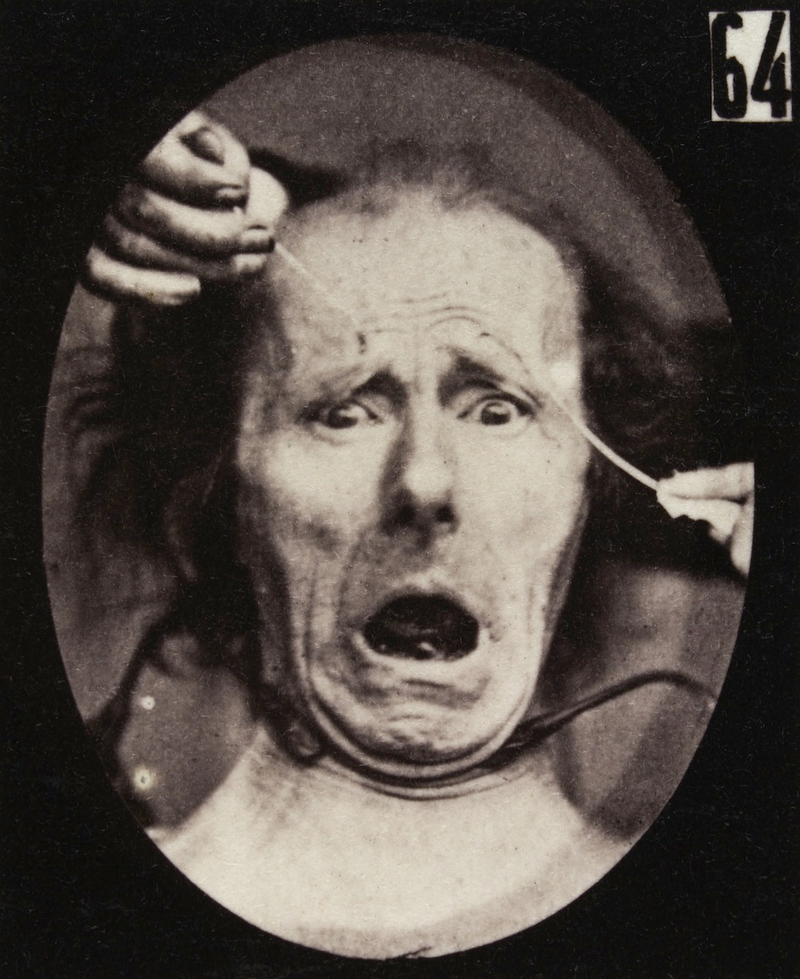 Illustration for article titled Terrifying, Century-Old Photographs from Neuroscience Experiments